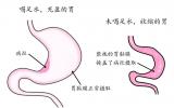 做PET/CT检查时，医生为什么让我“多喝水”？