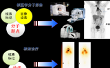 抗击肿瘤的“核”武器