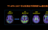 东诚药业全资子公司引进Tau蛋白正电子摄影示踪剂产品