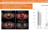 延迟SPECT改善前列腺癌检测